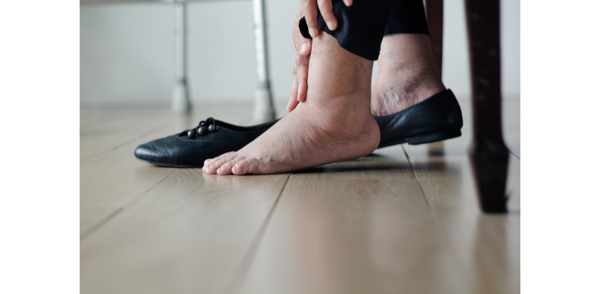 Best shoes for swollen 2025 ankles
